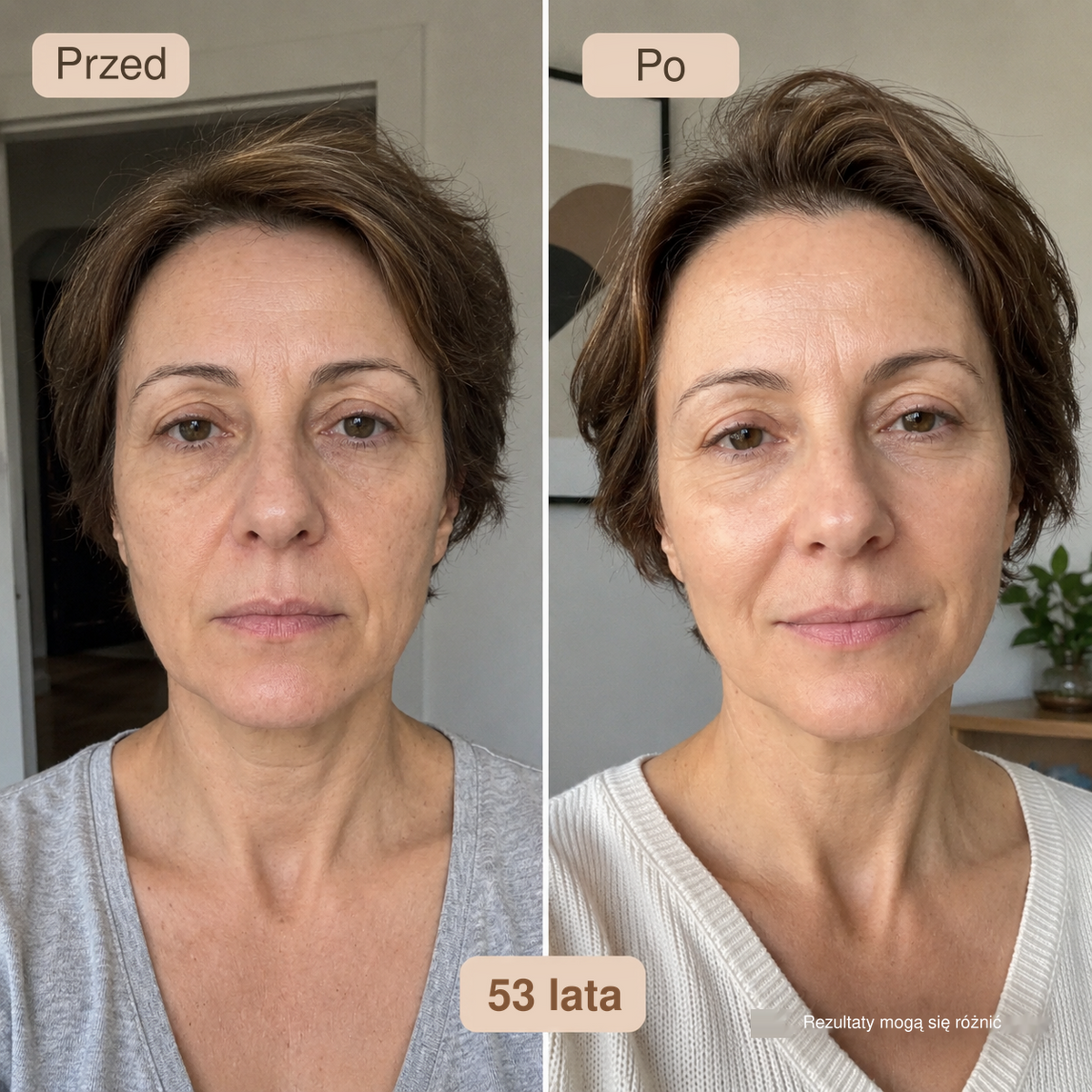 Soyun — serum z peptydami złotego jedwabiu — zdjęcie 11